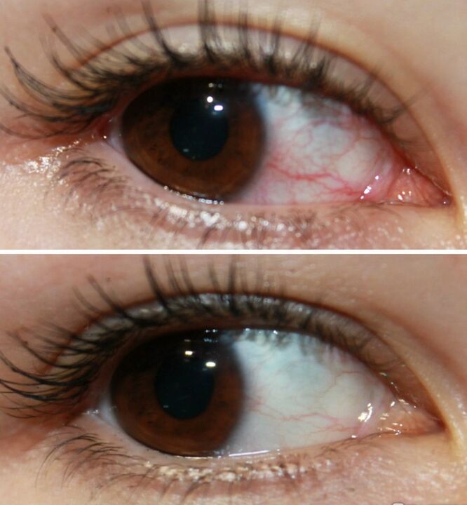 Ocuvit djeluje vrlo brzo